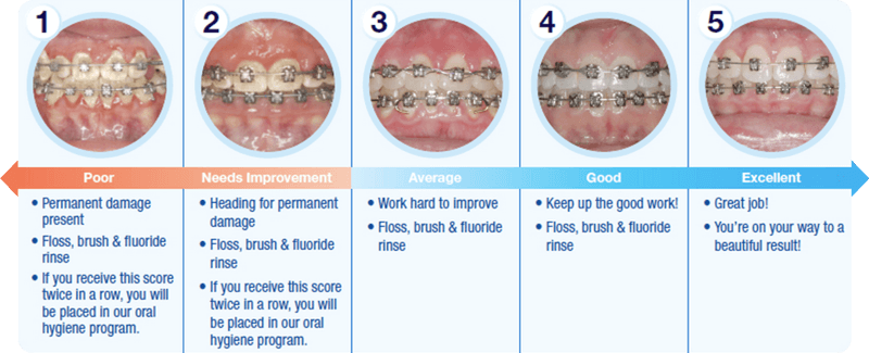 Grand Rapids Braces