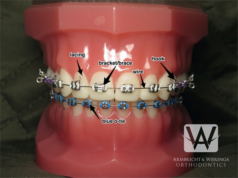 Rubber Bands Frequently Asked Questions