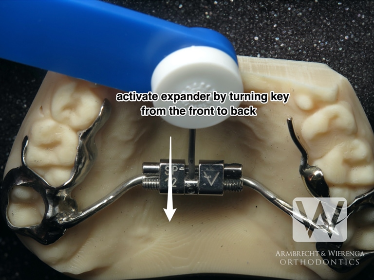 Braces Help Orthodontist in Grand Rapids
