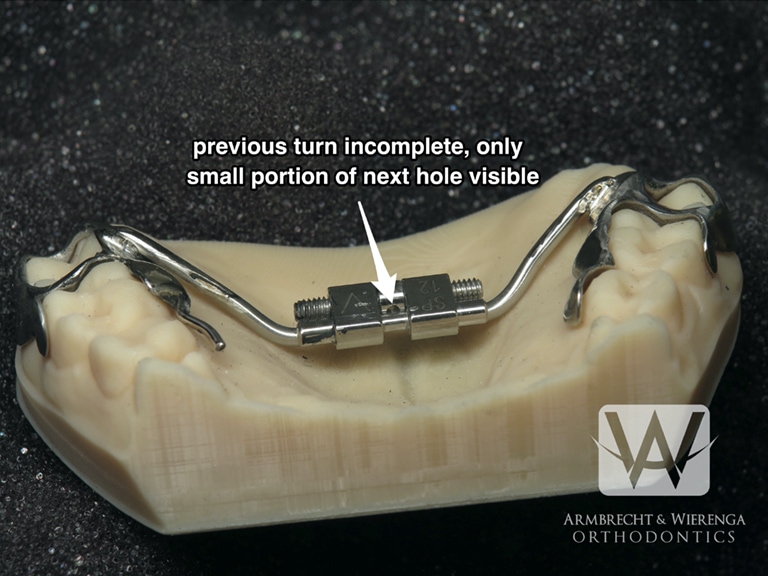 Braces Help Orthodontist in Grand Rapids