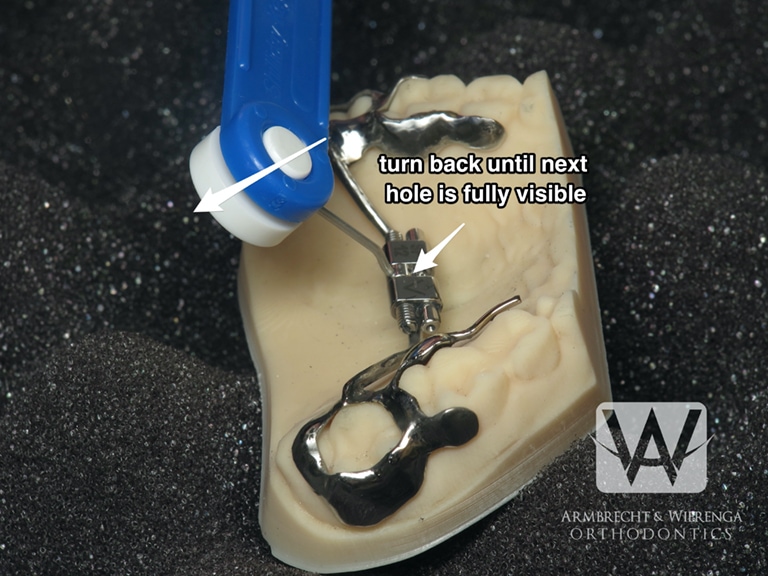 Braces Help Orthodontist in Grand Rapids