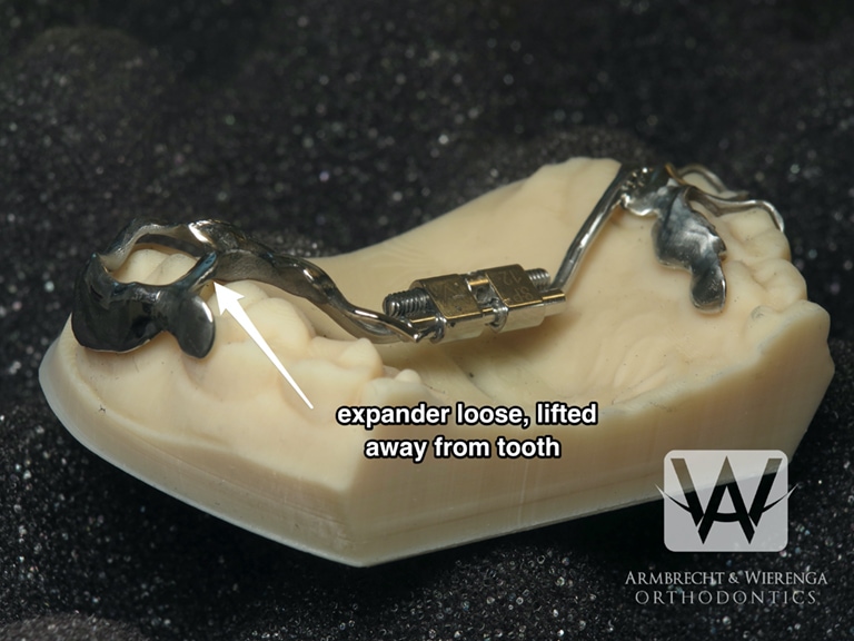 Braces Help Orthodontist in Grand Rapids