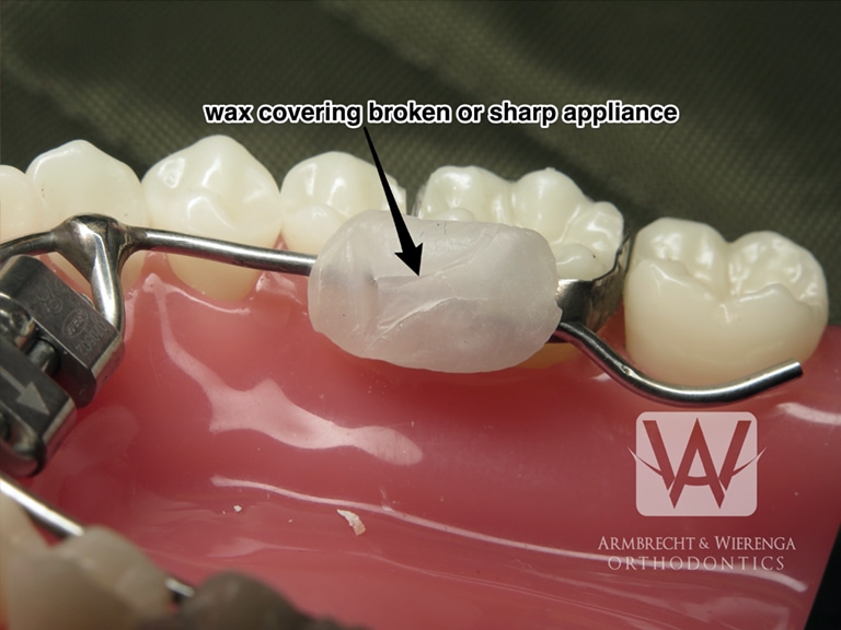 Braces Help Orthodontist in Grand Rapids
