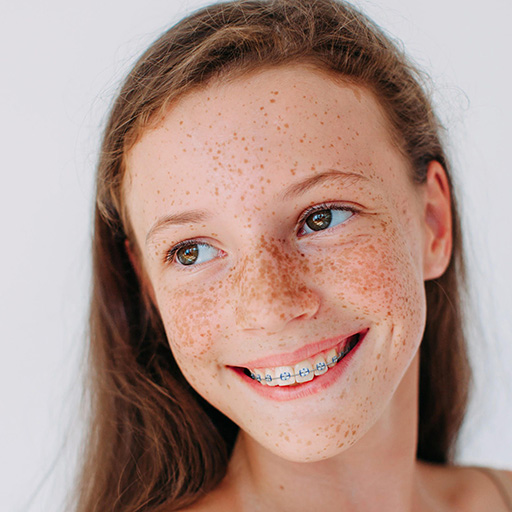Young girl with LightForce braces at AWBraces Young girl with LightForce braces at AWBraces